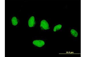 Immunofluorescence of purified MaxPab antibody to KIF4A on HeLa cell.