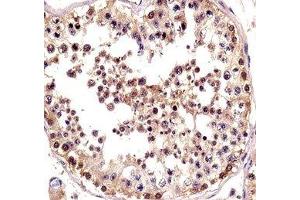 TSPY antibody immunohistochemistry analysis in formalin fixed and paraffin embedded human testis tissue.