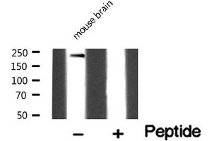 Western blot analysis of Dysferlin expression in Mouse brain lysate
