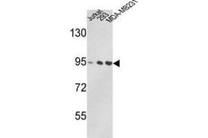 Western Blotting (WB) image for anti-Valosin Containing Protein (VCP) antibody (ABIN3002881) (VCP anticorps)