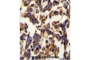Immunohistochemistry (IHC) image for anti-Berardinelli-Seip Congenital Lipodystrophy 2 (Seipin) (BSCL2) antibody (ABIN2995527) (BSCL2 anticorps)