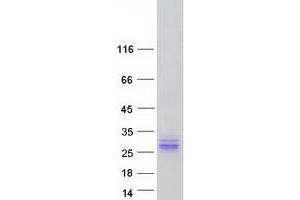 Validation with Western Blot