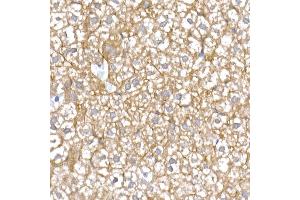 Immunohistochemistry of paraffin-embedded mouse liver using IQG Rabbit mAb (ABIN7268021) at dilution of 1:25 (40x lens). (IQGAP2 anticorps)