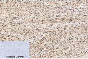 Immunohistochemical analysis of paraffin-embedded human uterus tissue.
