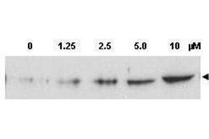 Western blot using  Affinity Purified anti-Chk2 pT68 antibody shows detection of a predominant band at ~60 kDa corresponding to phosphorylated Chk2 (arrowhead) in MCF-7 whole cell lysates after treatment with doxorubicin. (CHEK2 anticorps  (pThr68))