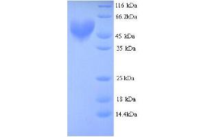 SDS-PAGE (SDS) image for Aryl Hydrocarbon Receptor Nuclear Translocator (ARNT) (AA 1-474), (partial) protein (His tag) (ABIN5713256)