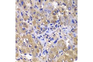 Immunohistochemistry of paraffin-embedded human liver damage using C antibody (ABIN6127549, ABIN6137937, ABIN6137938 and ABIN6223226) at dilution of 1:100 (40x lens). (CARD10 anticorps  (AA 863-1032))