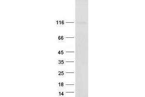 Validation with Western Blot