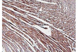IHC analysis of ALDOA using anti-ALDOA antibody (ABIN7601907). (ALDOA anticorps  (AA 50-364))