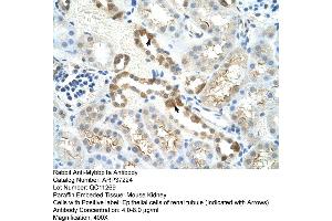 Mouse Lung (MYBBP1A anticorps  (C-Term))