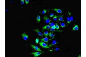 Immunofluorescent analysis of A549 cells using ABIN7149470 at dilution of 1:100 and Alexa Fluor 488-congugated AffiniPure Goat Anti-Rabbit IgG(H+L)