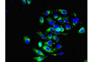Immunofluorescent analysis of A549 cells using ABIN7149470 at dilution of 1:100 and Alexa Fluor 488-congugated AffiniPure Goat Anti-Rabbit IgG(H+L) (DRD5 anticorps  (AA 361-477))
