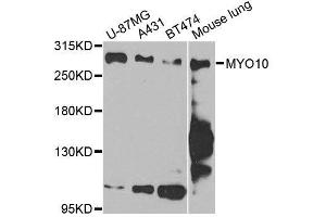 Western blot analysis of extracts of various cell lines, using MYO10 antibody. (Myosin X anticorps  (AA 845-944))