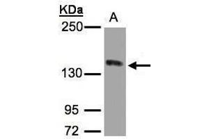 WB Image Sample(30 ug whole cell lysate) A:HeLa S3, 5% SDS PAGE antibody diluted at 1:1000 (c-MET anticorps  (C-Term))