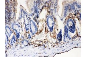 IHC-P: ABCB4 antibody testing of mouse intestine tissue (ABCB4 anticorps  (AA 601-720))