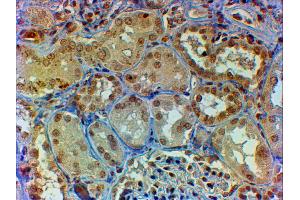 Immunohistochemistry (IHC) image for anti-V-Myb Myeloblastosis Viral Oncogene Homolog (Avian) (MYB) (AA 281-294) antibody (ABIN5929019) (MYB anticorps  (AA 281-294))
