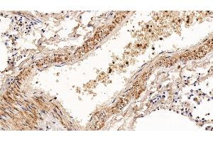 Detection of CNN1 in Human Lung Tissue using Polyclonal Antibody to Calponin 1, Basic (CNN1) (CNN1 anticorps  (AA 1-268))
