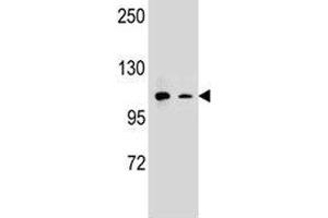 CD11b antibody western blot analysis in (1) A549 and (2) K562 lysate