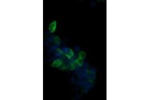 Image no. 2 for anti-UDP-GlcNAc:BetaGal beta-1,3-N-Acetylglucosaminyltransferase 2 (B3GNT2) antibody (ABIN1496800)
