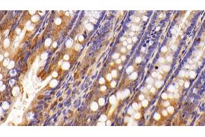 Detection of GAL8 in Rat Colon Tissue using Polyclonal Antibody to Galectin 8 (GAL8)