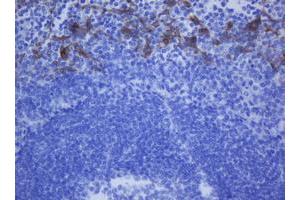 anti-Keratin 20 (KRT20) (AA 1-266) antibody