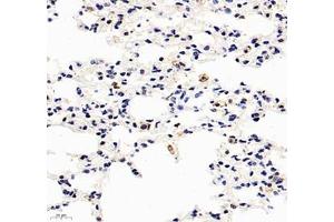 Immunohistochemistry of paraffin embedded mouse lung using HSP70B (ABIN7074173) at dilution of 1: 1000 (400x lens)
