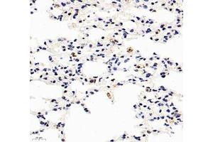 Immunohistochemistry of paraffin embedded mouse lung using HSP70B (ABIN7074173) at dilution of 1: 1000 (400x lens) (HSPA6 anticorps)