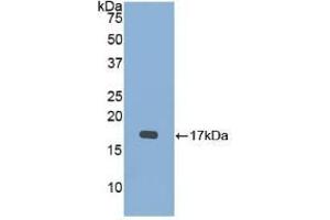 Detection of Recombinant BMP15, Mouse using Polyclonal Antibody to Bone Morphogenetic Protein 15 (BMP15)