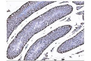IHC analysis of KMT1B/SUV39H2 using anti-KMT1B/SUV39H2 antibody (ABIN7602135). (SUV39H2 anticorps  (AA 6-410))