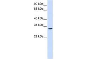 Image no. 1 for anti-Kv Channel Interacting Protein 4 (KCNIP4) (N-Term) antibody (ABIN6742500) (KCNIP4 anticorps  (N-Term))
