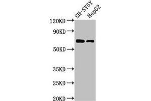 Western Blot Positive WB detected in: SH-SY5Y whole cell lysate, HepG2 whole cell lysate All lanes: C7orf31 antibody at 2. (C7orf31 anticorps  (AA 163-256))