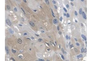 DAB staining on IHC-P; Samples: Human Esophagus (Arylsulfatase A anticorps  (AA 21-295))