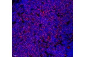 Immunofluorescence of paraffin embedded mouse thymus using Lat (ABIN7074502) at dilution of 1: 2100 (400x lens) (LAT anticorps)