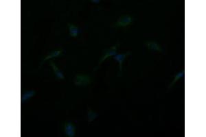 Image no. 3 for anti-Glioblastoma Amplified Sequence (GBAS) antibody (ABIN1498394)