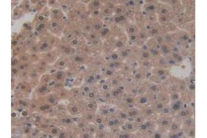 IHC-P analysis of Mouse Liver Tissue, with DAB staining. (SIRT3 anticorps  (AA 5-257))