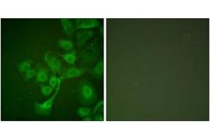Immunofluorescence analysis of A549 cells, using TIMP2 Antibody. (TIMP2 anticorps  (AA 21-70))