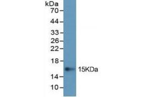 Rabbit Detection antibody from the kit in WB with Positive Control: Sample Human lung tissue lysate.