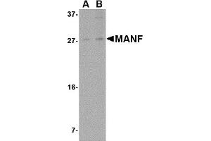 Western Blotting (WB) image for anti-Mesencephalic Astrocyte-Derived Neurotrophic Factor (MANF) (N-Term) antibody (ABIN1031449) (MANF anticorps  (N-Term))