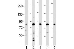 Western blot testing of human 1) HeLa, 2) HL-60, 3) THP-1, 4) CCRF-CEM and 5) SH-SY5Y cell lysate with LRCH4 antibody at 1:2000. (LRCH4 anticorps  (AA 305-348))