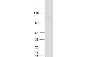 Validation with Western Blot