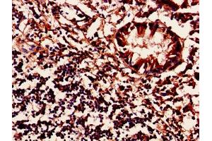 Immunohistochemistry of paraffin-embedded human appendix tissue using ABIN7142447 at dilution of 1:100 (MRPL54 anticorps  (AA 15-138))