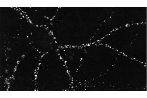 ICC of PSD95 in cultures of dissociated hippocampal neurons. (DLG4 anticorps  (Atto 390))