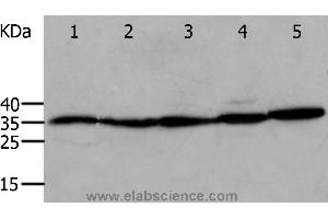 Western blot analysis of Mouse eyes and heart, Human cervical cancer tissue, OP9 and RAW264. (Annexin V anticorps)