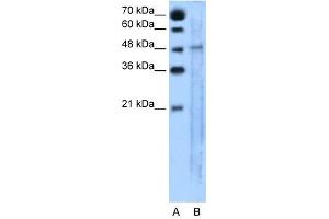 SLC25A46 antibody used at 5 ug/ml to detect target protein. (SLC25A46 anticorps  (N-Term))