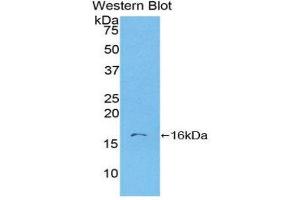Western Blotting (WB) image for anti-S100 Calcium Binding Protein A6 (S100A6) (AA 1-90) antibody (ABIN3201618) (S100A6 anticorps  (AA 1-90))