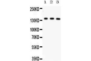 Anti- ABCB11 Picoband antibody, Western blotting All lanes: Anti ABCB11  at 0. (ABCB11 anticorps  (C-Term))