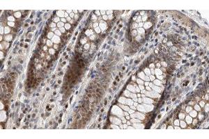 ABIN6275170 at 1/100 staining Rat colon tissue by IHC-P. (GIMAP5 anticorps  (Internal Region))