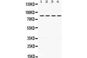 Western Blotting (WB) image for anti-Phosphoinositide 3 Kinase, p85 beta (PI3K p85b) (AA 427-463), (Middle Region) antibody (ABIN3043605)