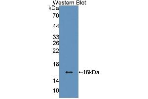 Detection of Recombinant CD7, Human using Polyclonal Antibody to Cluster Of Differentiation 7 (CD7) (CD7 anticorps  (AA 26-134))
