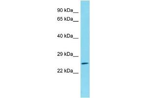 Host: Rabbit Target Name: C1orf105 Sample Type: HepG2 Whole Cell lysates Antibody Dilution: 1. (C1ORF105 anticorps  (N-Term))